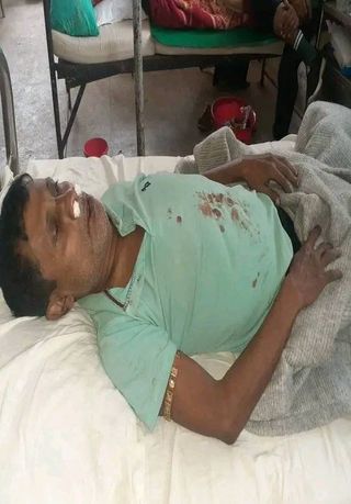 বোরহানউদ্দিনে জমি নিয়ে বিরোধের জেরে স্বামী ও স্ত্রীর ওপর হামলার অভিযোগ আহত ২ 