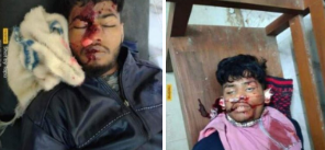 মাধবপুরে সড়ক দুর্ঘটনায় দুই মোটরসাইকেল আরোহী নিহত 