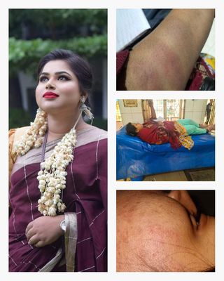 সাভারে ঘরে ঢুকে ছাত্রলীগ নেত্রী বাবলী আক্তার-কে হত্যাচেষ্টা 