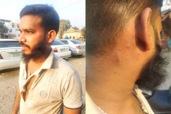 ধামরাইতে সরেজমিন বার্তা পত্রিকার সাংবাদিক ও মানবাধিকার কর্মীর উপর সন্ত্রাসী হামলা 