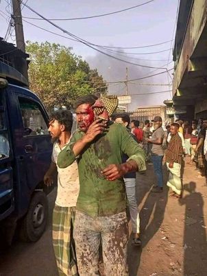 সীতাকুণ্ডে অক্সিজেন প্ল্যান্টে বিস্ফোরণে নিহত বেড়ে ৬ জন আহত ৪৫ জন। 