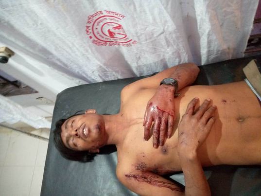 বান্দরবান থানচি সিমান্তে সন্ত্রাসীদের গুলিতে ২ ট্রাক চালক আহত।