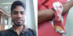 চাঁদা না পেয়ে তজুমদ্দিন উপজেলার শম্ভুপুর খাসের হাট বাজারের ব্যবসায়ী ও যুবলীগ নেতা আল আমিনের উপর সন্ত্রাসী হামলা