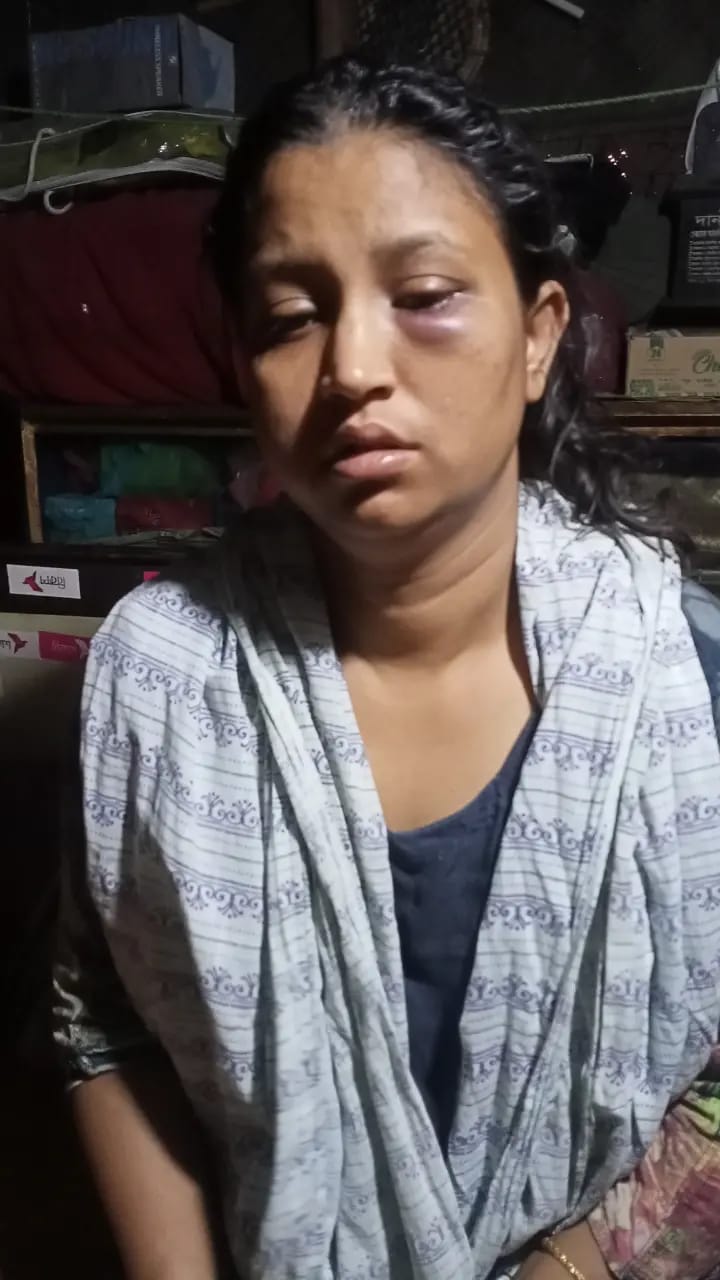 চট্টগ্রামে বিরোধের জেরে প্রতিপক্ষের হামলা, হত্যাচেষ্টা। ২ মহিলাকে কুপিয়ে জখম, একজনের আঙুল বিচ্ছিন্ন