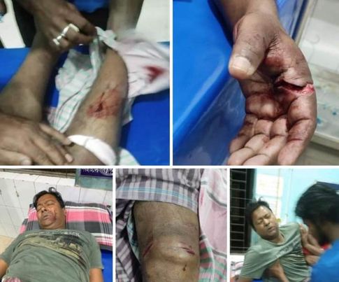 কুমারখালীতে ডাকাতি, লুটপাট সহ গৃহকর্তা ও গৃহকর্মীকে কুপিয়ে জখম
