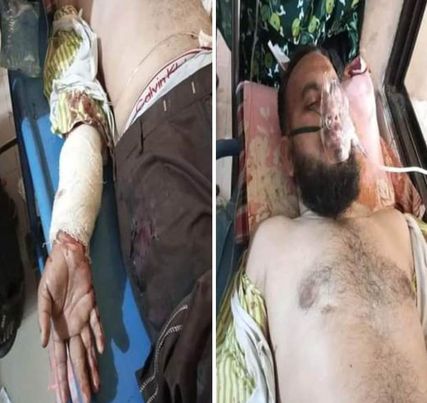 কুষ্টিয়ায় মুদি দোকান ব্যবসায়ীকে ছুরিকাঘাত করে টাকা ছিনতাই