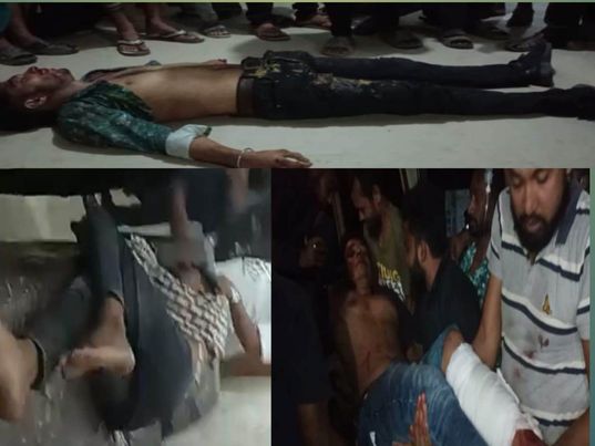মধুমতী সেতুতে পথচারীর সাথে মোটরসাইকেল দুর্ঘটনায় নিহত ১ আহত ২. 