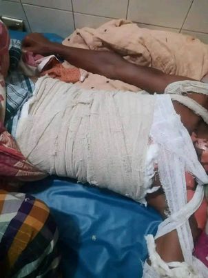 বজ্রপাতে মারাত্মকভাবে আহত হলো এক যুবক ।