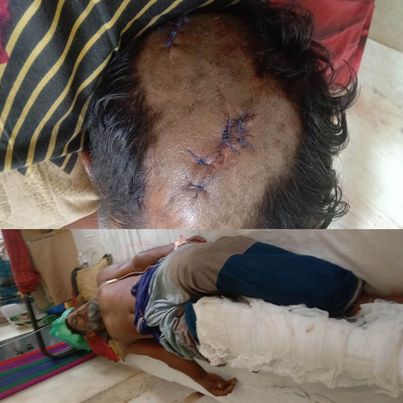 কালিয়ায় জমি সংক্রান্ত বিরোধের জেরে আপন ভাইকে হত্যা চেষ্টা! থানায় মামলা দায়ের!