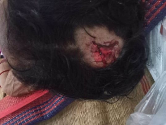 ​​​​​​​শার্শার আমলাই পূর্ব শত্রুতার জেরে গৃহবধূকে পিটিয়ে জখম 