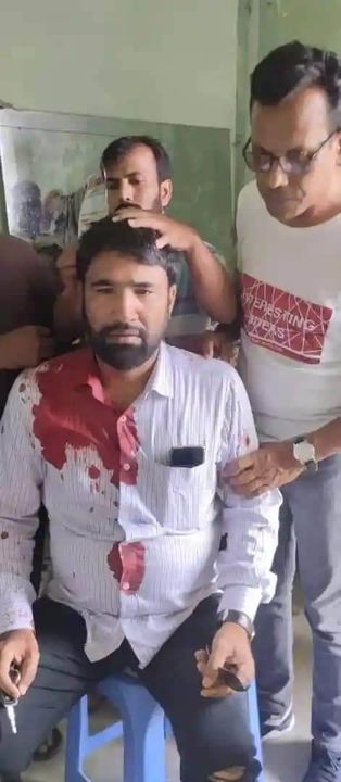 হামলায় আহত উপজেলা বিএনপির আহ্বায়ক এবিএম তৌফিক হাসান