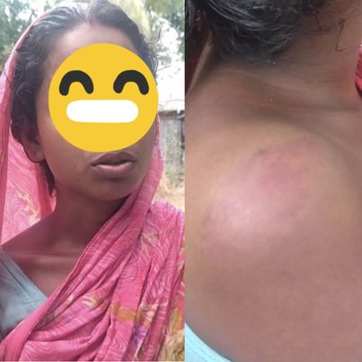 এলাকার বখাটেদের কুপ্রস্তাব রাজি না হওয়ায় মারপিট। 