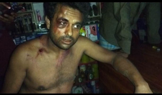 নড়াগাতীতে জমিজমা সংক্রান্ত বিষয়ে চাচা, ভাতিজা ও ভাবি কে কুপিয়েছে ! 