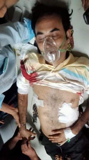 নোয়াখালী সদর সাবেক মেম্বার সন্ত্রাসীদের গুলিতে আহত