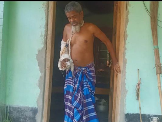 লোহাগড়ায় সম্পত্তি লিখে নিতে ভাই ও তার বউ কে মেরে হাত পা ভেঙ্গে দেওয়ার অভিযোগ। 