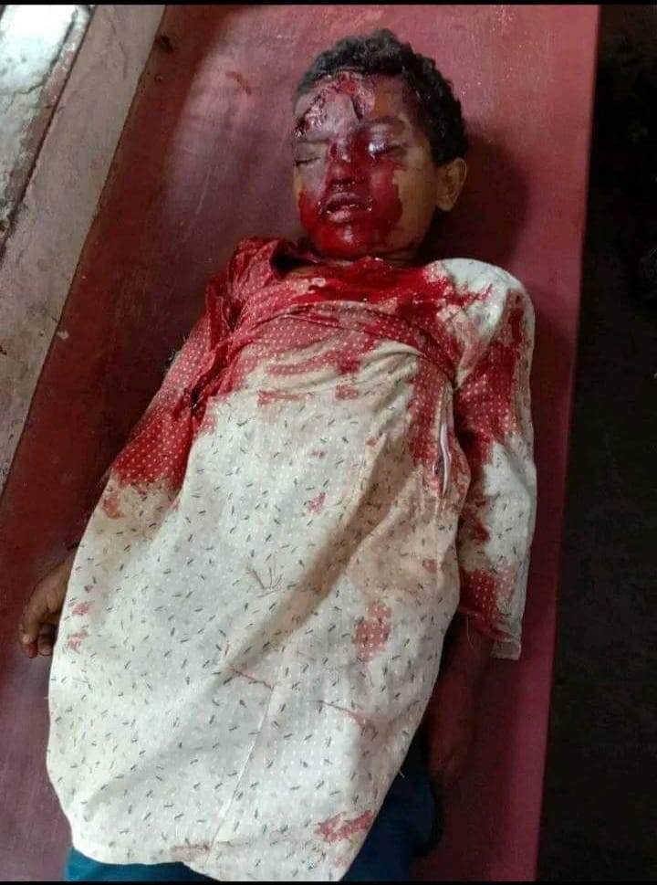 বাউফলে চালক বাবার ট্রলি গাড়ি থেকে ছিটকে পড়ে সন্তানের মৃত্যু। 
