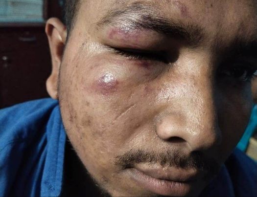 পাইকগাছায় উপজেলা ছাত্রলীগের নেতাকে পিটিয়ে আহত করলেন হরিঢালী ইউপি ছাত্রলীগ নেতা পাপ্পু.. 