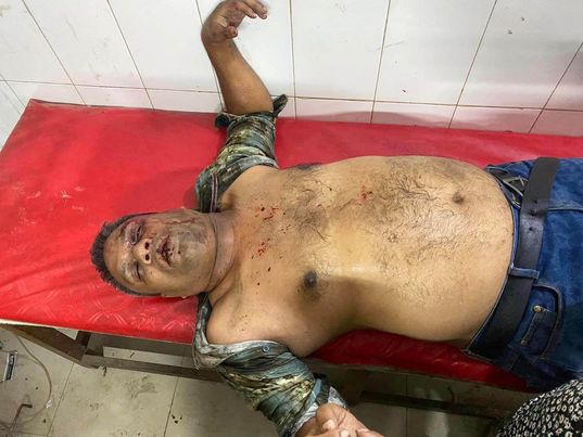 জামালপুরের বকশীগঞ্জে সন্ত্রাসীদের হামলায় গুরুত্বর আহত সাংবাদিক নাদিমের মৃত্যু; আটক ৩।