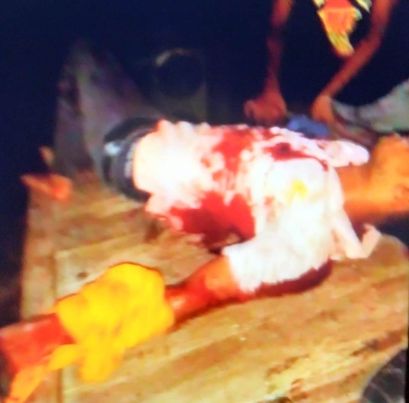 মাদারীপুরে মোবাইলফোনে ডেকে নিয়ে কিশোরের হাত কেটে বিচ্ছিন্ন করল দুর্বৃত্তরা