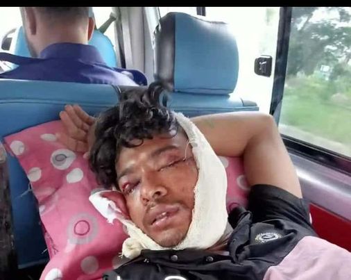 নোয়াখালীতে কারাগারে ঘুমের ভিতর হাজতির ২ চোখ নষ্ট করে দিল কয়েদী ---