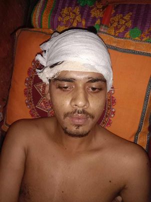 জাল দলিলকারী সামসুল আলমের নির্দেশে জমি- জমা বিরোধের জেরে হামলা: আহত ২