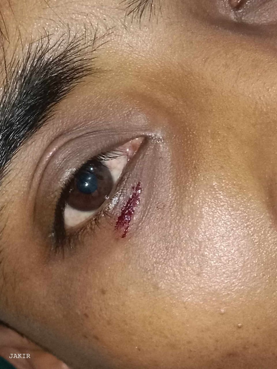 দুর্গাপুর উপজেলা ৬ নং কাকৈরগড়া ইউনিয়ন ৯ নং ওয়ার্ড যুবলীগের সাধারণ সম্পাদক মোঃ জাহাঙ্গীর মিয়ার উপর বিএনপির অতর্কিত হামলা