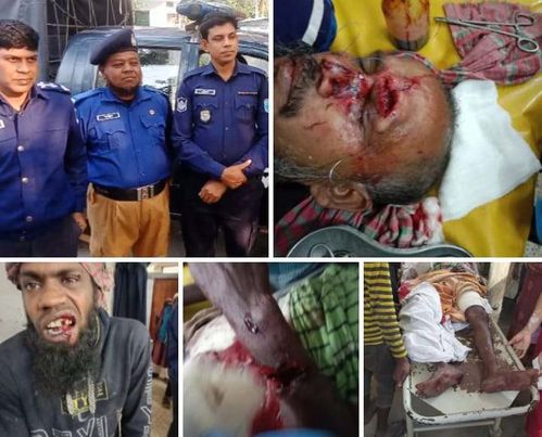 গোপালগঞ্জের বোড়াশীর মিটু মেম্বারের তান্ডবে গুরুতর আহত-১৬