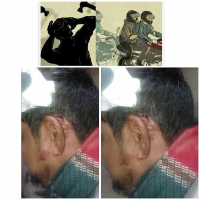 ফরিদপুরে হেলমেট ও হাতুরি বাহিনীর হামলার শিকার আজমত শেখ।