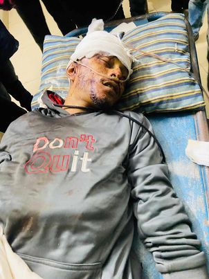 সন্দ্বীপে বিদ্যুৎতের খুঁটি থেকে পড়ে এক শ্রমিকের মৃত্যু 