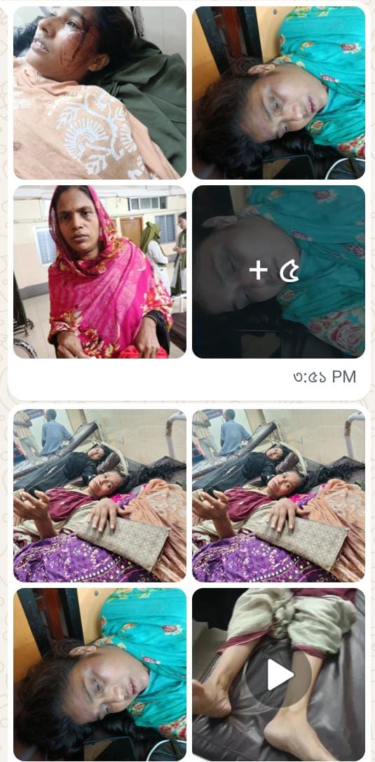 চট্টগ্রামে ‘সিন্টু বাহিনীর’ নারকীয় হামলা: পাঁচ নারী গুরুতর আহত, এলাকাবাসীর মাঝে চরম আতঙ্ক