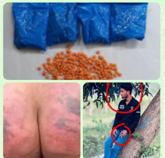বৈলছড়ি বাজার সংলগ্ন এলাকায় সংঘর্ষ: কথিত মাদক চালান নিয়ে উত্তেজনা, দুইজন আহত